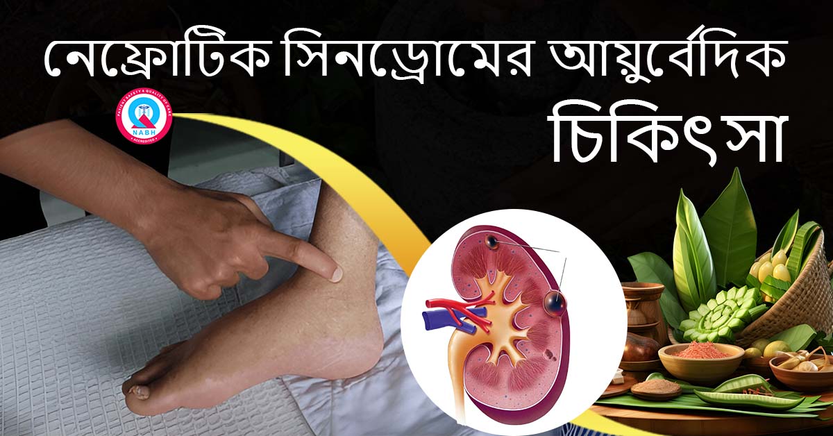 ayurvedic-treatment-for-nephrotic-syndrome